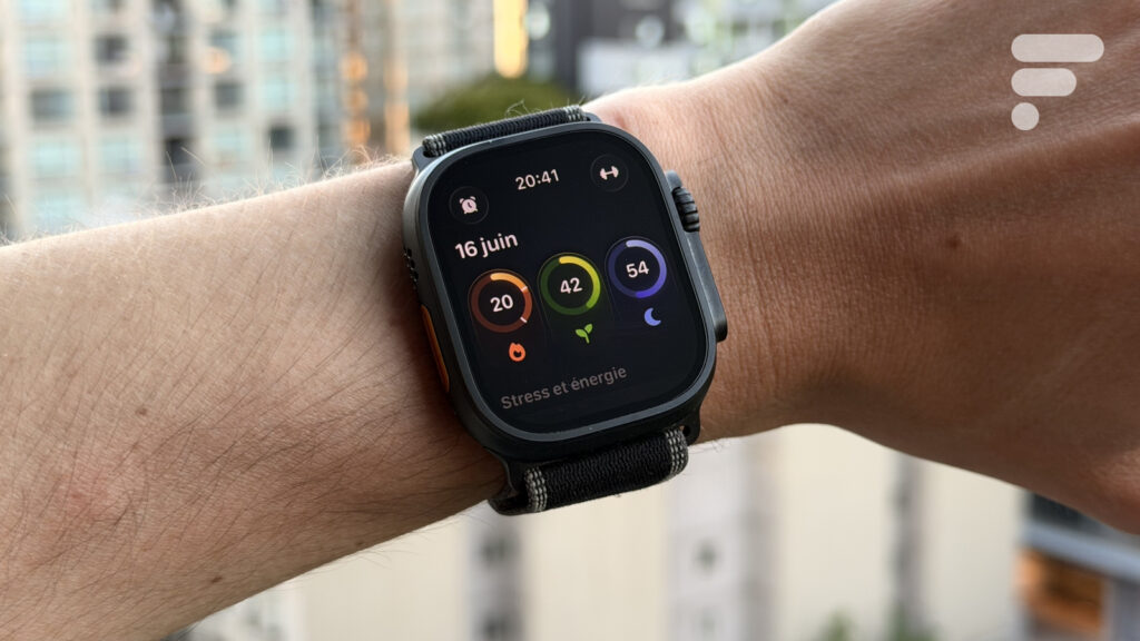 Bevel et Apple Watch : mon bilan après 6 mois d’utilisation pour optimiser ma santé